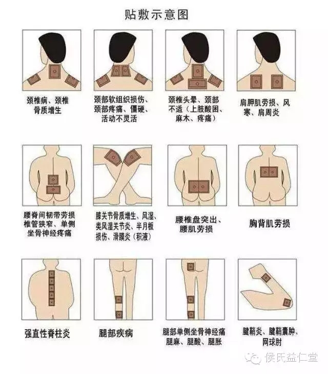 1467337708680504.jpeg 640.webp.jpg